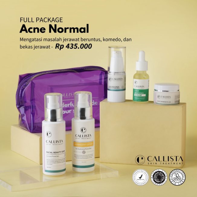 CALLISTA Acne Treatment